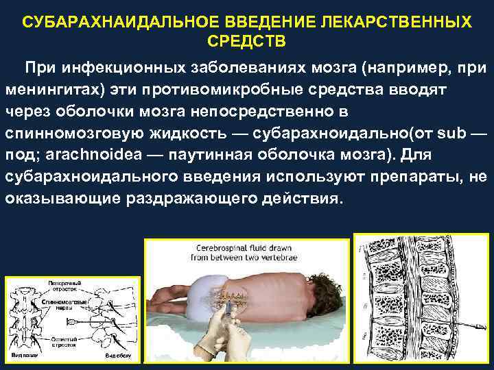 СУБАРАХНАИДАЛЬНОЕ ВВЕДЕНИЕ ЛЕКАРСТВЕННЫХ СРЕДСТВ При инфекционных заболеваниях мозга (например, при менингитах) эти противомикробные средства