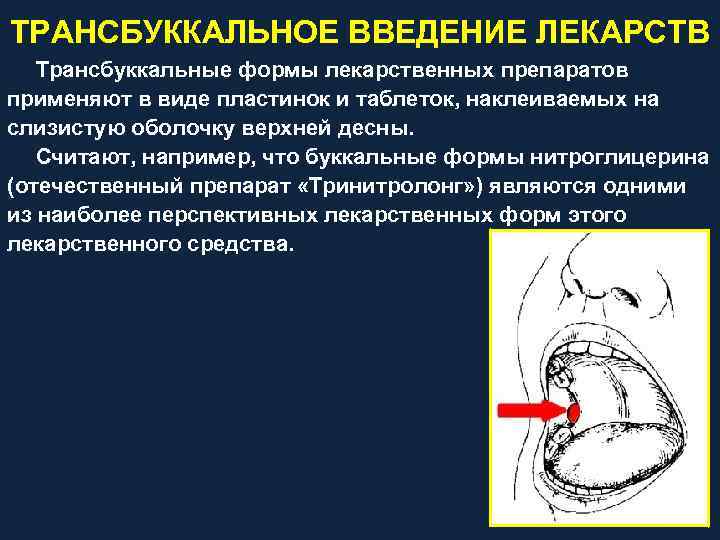 Схема введение лекарственного средства на слизистые