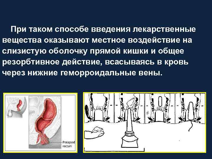 Геморроидальное кровотечение карта вызова