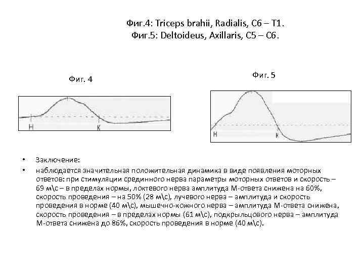 Фиг. 4: Triceps brahii, Radialis, C 6 – T 1. Фиг. 5: Deltoideus, Axillaris,