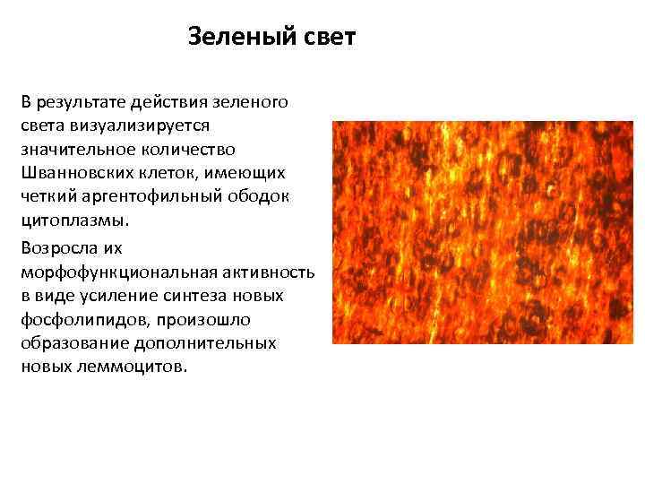 Зеленый свет В результате действия зеленого света визуализируется значительное количество Шванновских клеток, имеющих четкий