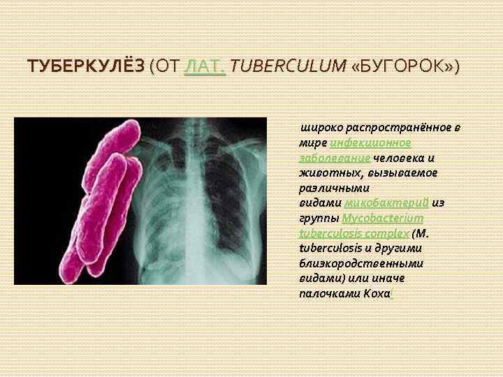 ТУБЕРКУЛЁЗ (ОТ ЛАТ. TUBERCULUM «БУГОРОК» ) широко распространённое в мире инфекционное заболевание человека и
