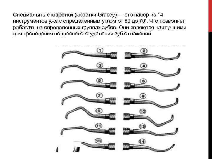 Специальные кюретки (кюретки Gracey) — это набор из 14 инструментов уже с определенным углом