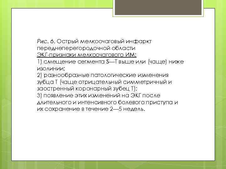 Рис. 6. Острый мелкоочаговый инфаркт переднеперегородочной области ЭКГ-признаки мелкоочагового ИМ: 1) смещение сегмента S—Т