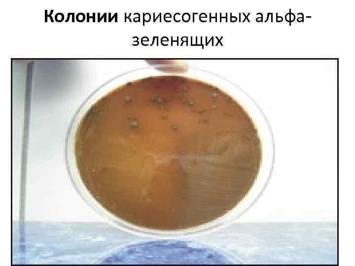 Колонии кариесогенных альфазеленящих 