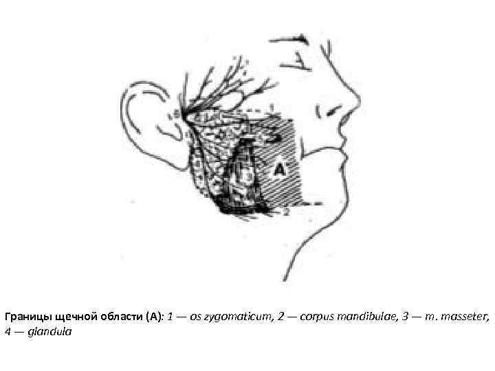 Границы щечной области (А): 1 — os zygomaticum, 2 — corpus mandibulae, 3 —