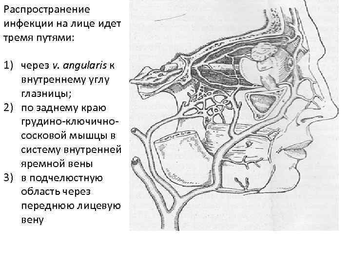 Абсцесс челюстно язычного желобка фото