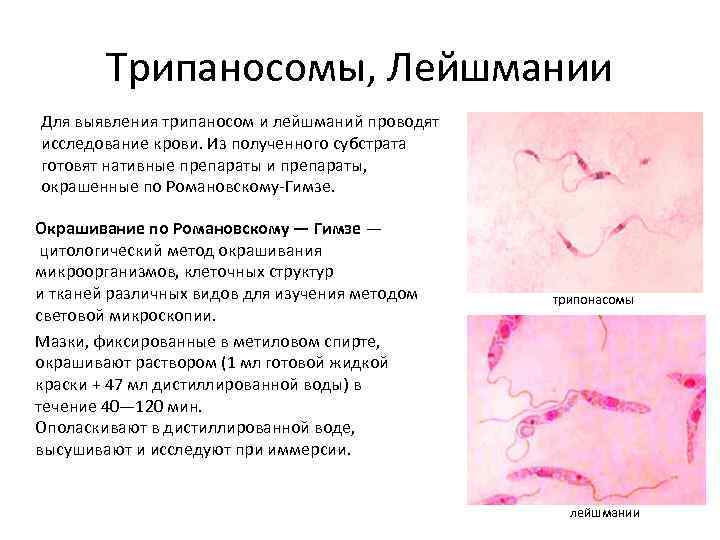 Перечислите методы обнаружения простейших образцы каких тканей берутся на исследование