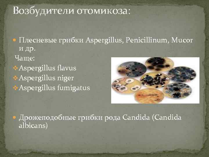 Возбудители отомикоза: Плесневые грибки Aspergillus, Penicillinum, Mucor и др. Чаще: v Aspergillus flavus v