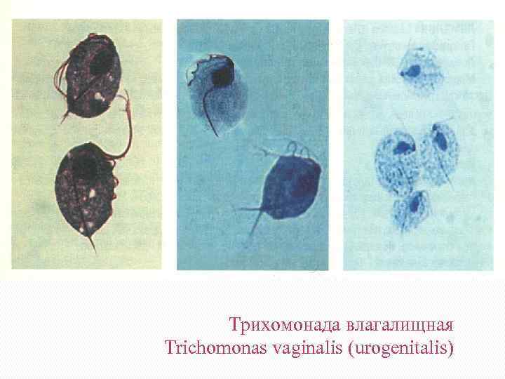 Трихомонада влагалищная Trichomonas vaginalis (urogenitalis) 