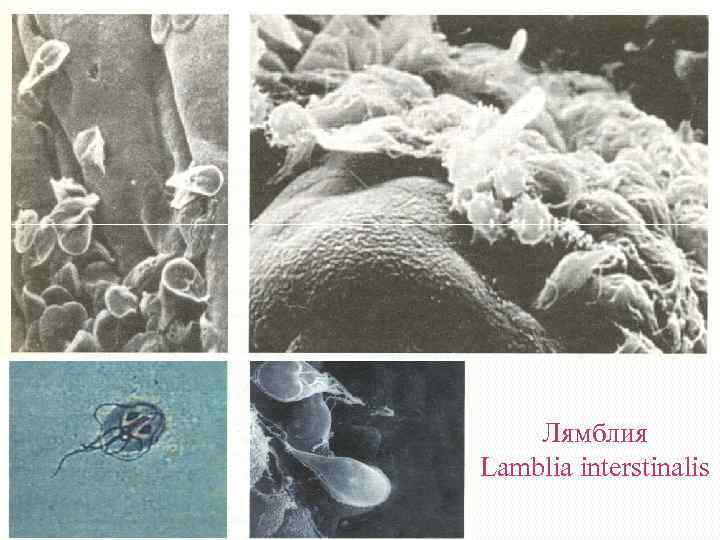 Лямблия Lamblia interstinalis 