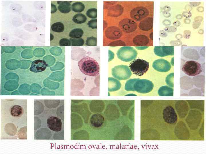 Plasmodim ovale, malariae, vivax 