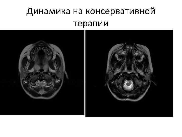 Динамика на консервативной терапии 