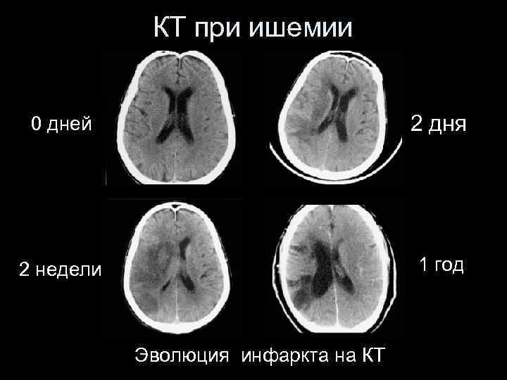 Инсульт современные технологии диагностики и лечения руководство для врачей