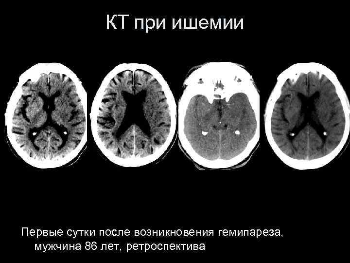 Инсульт современные технологии диагностики и лечения руководство для врачей