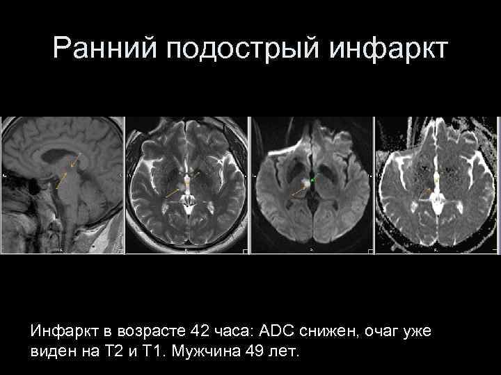 Инсульт современные технологии диагностики и лечения руководство для врачей