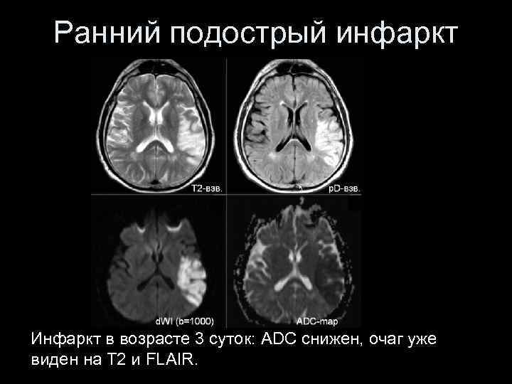 Инсульт современные технологии диагностики и лечения руководство для врачей