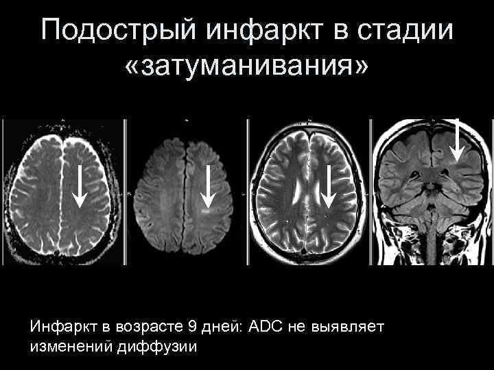 Инсульт современные технологии диагностики и лечения руководство для врачей