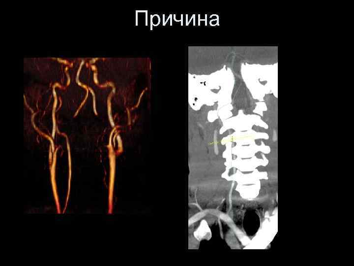 Инсульт современные технологии диагностики и лечения руководство для врачей