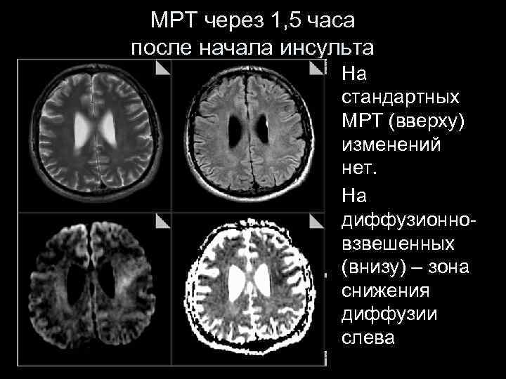 Диффузионно взвешенное изображение