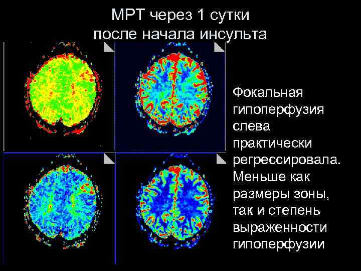 Инсульт современные технологии диагностики и лечения руководство для врачей