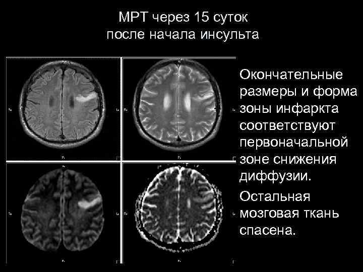 Инсульт современные технологии диагностики и лечения руководство для врачей