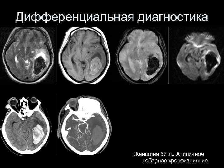 Инсульт современные технологии диагностики и лечения руководство для врачей