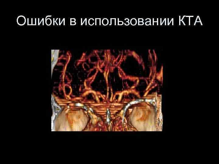 Ошибки в использовании КТА 