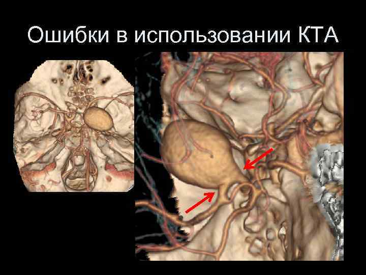 Ошибки в использовании КТА 