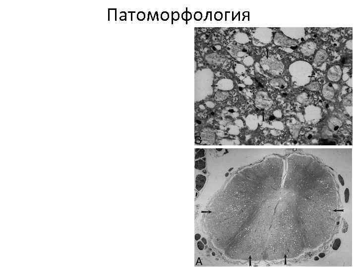 Патоморфология 