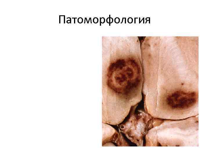 Патоморфология 