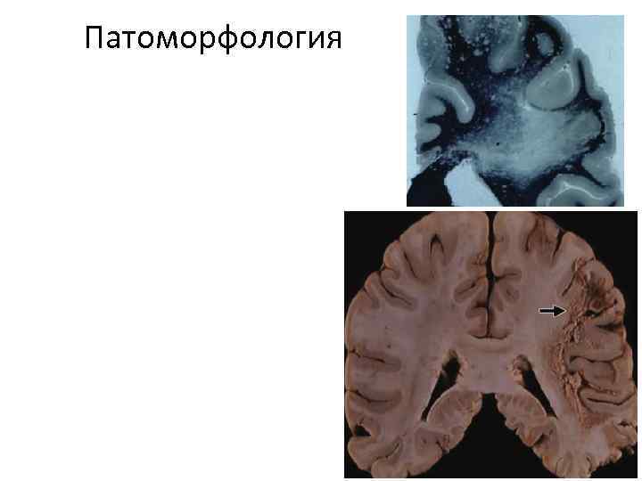 Патоморфология 