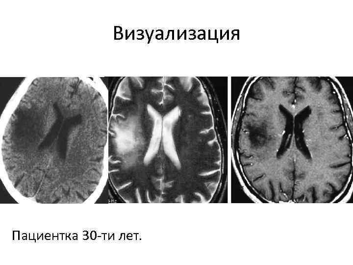 Визуализация Пациентка 30 -ти лет. 