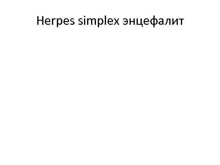 Herpes simplex энцефалит 