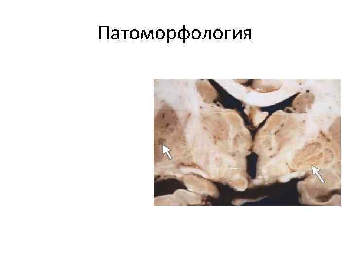 Патоморфология 