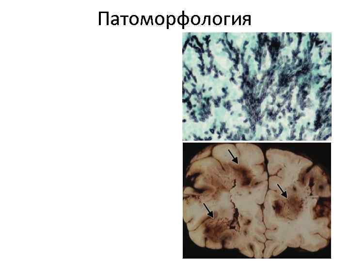 Патоморфология 