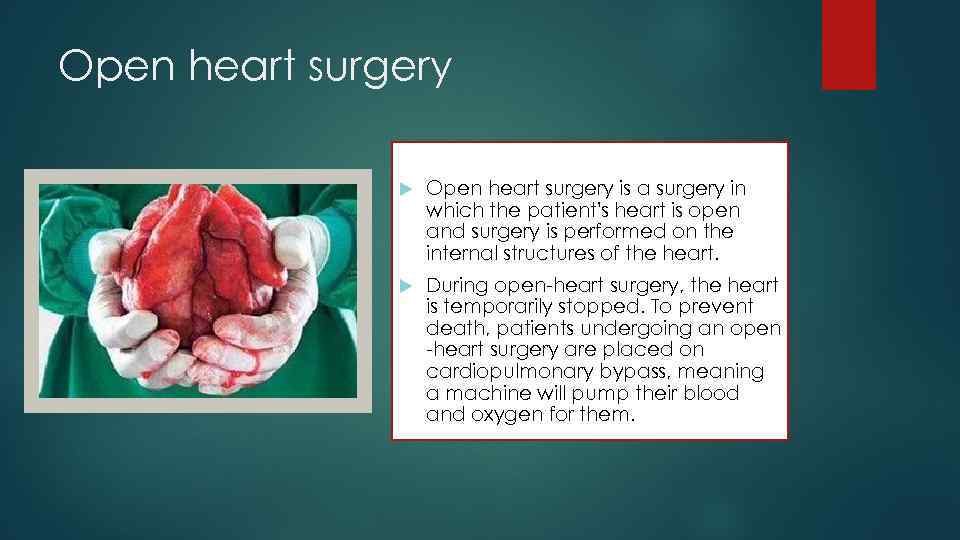 Open heart surgery is a surgery in which the patient's heart is open and