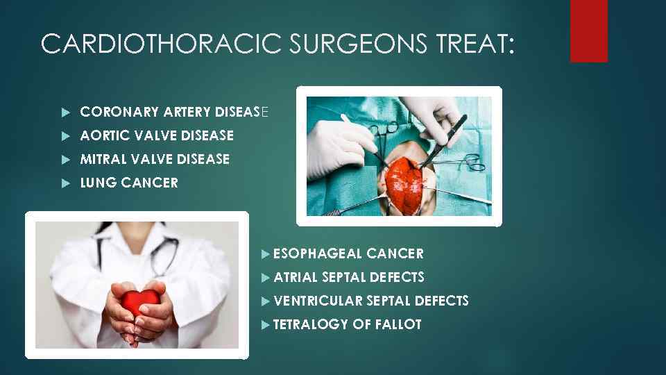 CARDIOTHORACIC SURGEONS TREAT: CORONARY ARTERY DISEASE AORTIC VALVE DISEASE MITRAL VALVE DISEASE LUNG CANCER