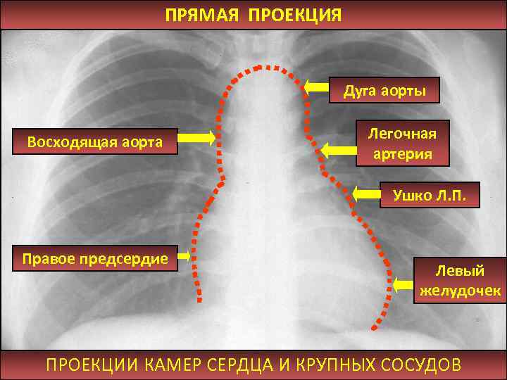 Проекция дуги