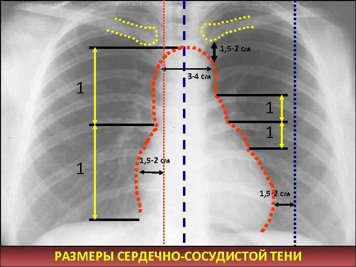 1, 5 -2 см 3 -4 см 1 1 1, 5 -2 см РАЗМЕРЫ