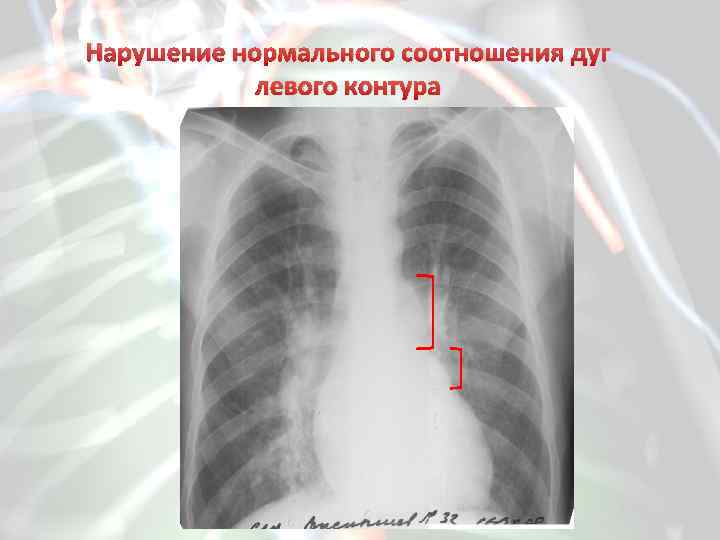 Методы лучевого исследования сердца и сосудов презентация