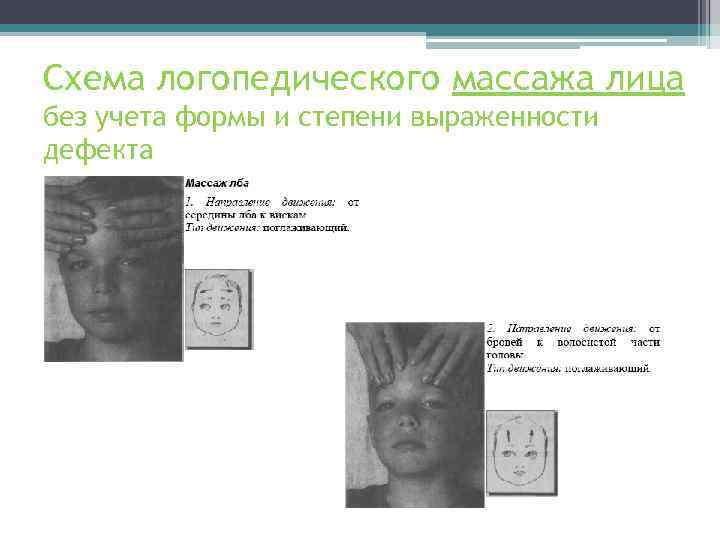 Схема логопедического массажа лица без учета формы и степени выраженности дефекта 