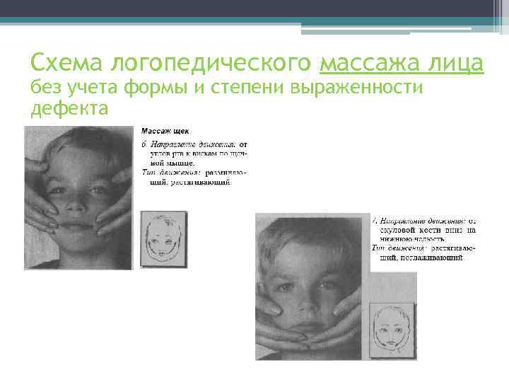 Схема логопедического массажа лица без учета формы и степени выраженности дефекта 