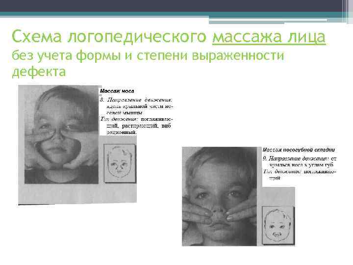 Схема логопедического массажа лица без учета формы и степени выраженности дефекта 