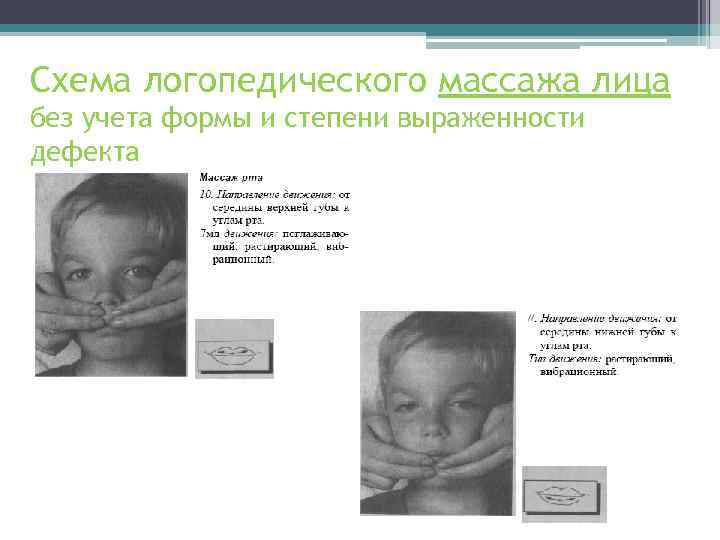 Схема логопедического массажа лица без учета формы и степени выраженности дефекта 