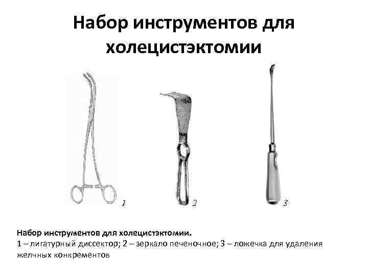 Набор инструментов для холецистэктомии. 1 – лигатурный диссектор; 2 – зеркало печеночное; 3 –
