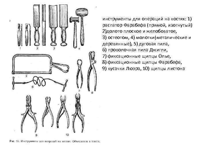 инструменты для операций на костях: 1) распатор Фарабефа (прямой, изогнутый) 2)долото плоское и желобоватое,