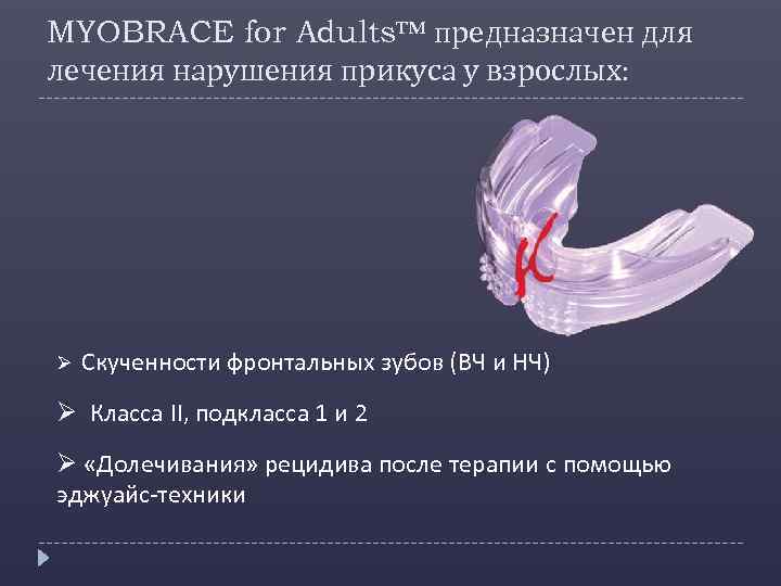 MYOBRACE for Adults™ предназначен для лечения нарушения прикуса у взрослых: Ø Скученности фронтальных зубов