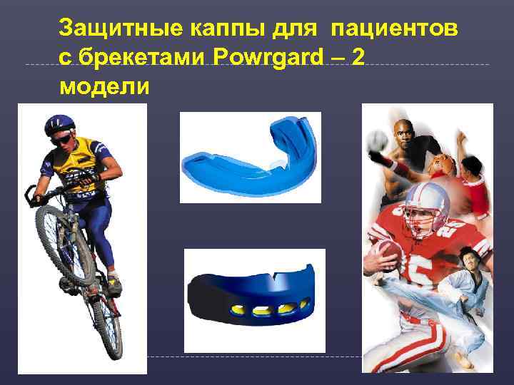 Защитные каппы для пациентов с брекетами Powrgard – 2 модели 