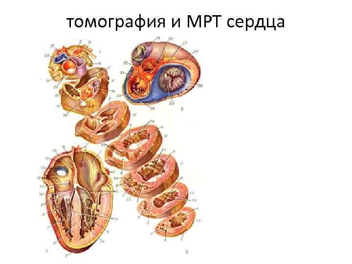 Места проекции клапанов сердца